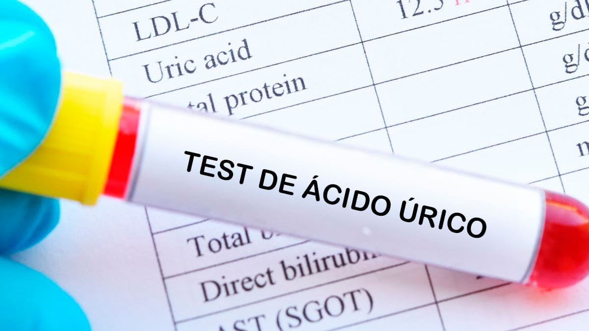Test de ácido úrico